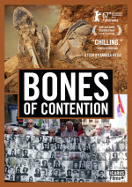 Bones of Contention