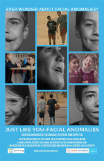 Just Like You - Facial Anomalies